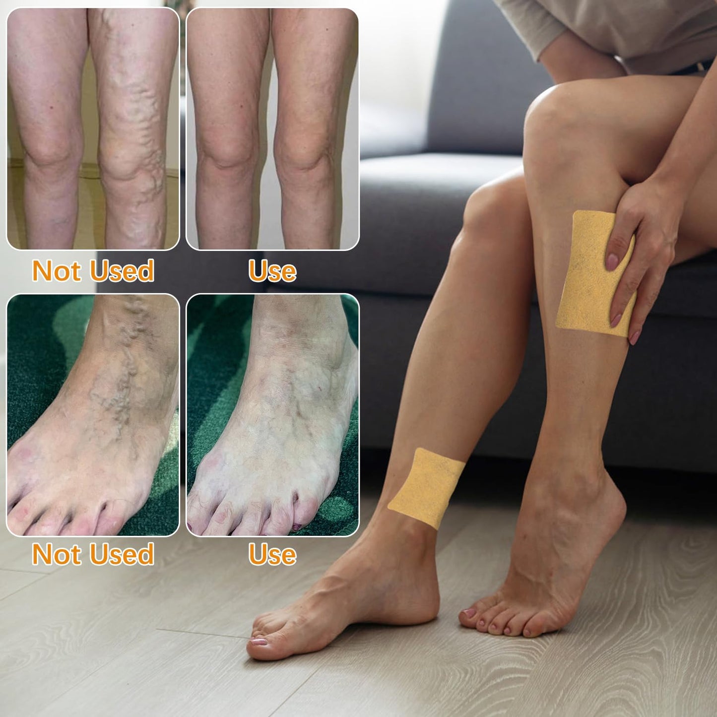 Turmeric Varicose Vein Patches
