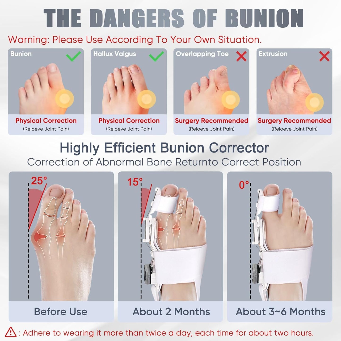 🦶 New Upgrade Bunion Corrector