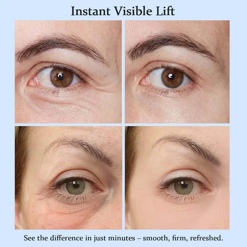 Instant Eye Lift Cream-Under-Eye Tightener (Buy 1 Get 1 Free)